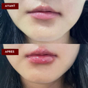 GLOSS REPULPANT - L’alternative aux injections