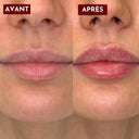 GLOSS REPULPANT - L’alternative aux injections